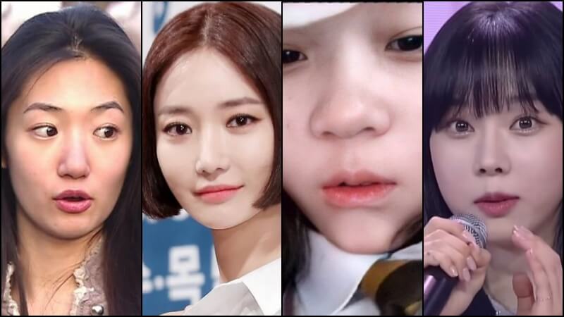 주먹코 미인 열전, 90년대부터 MZ세대까지 고준희 윈터 코