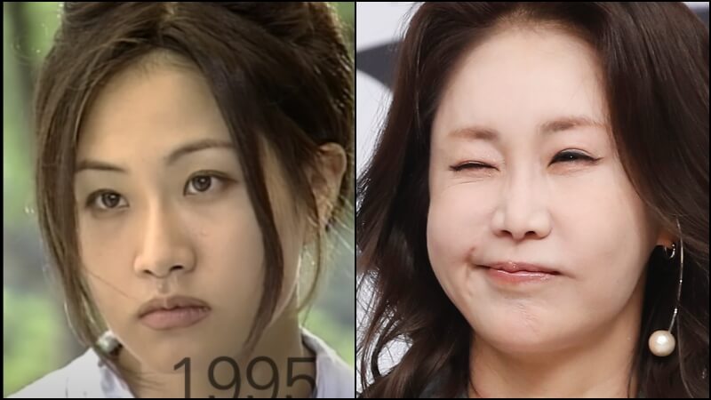 주먹코에서 들창코로 변한 신은경 코