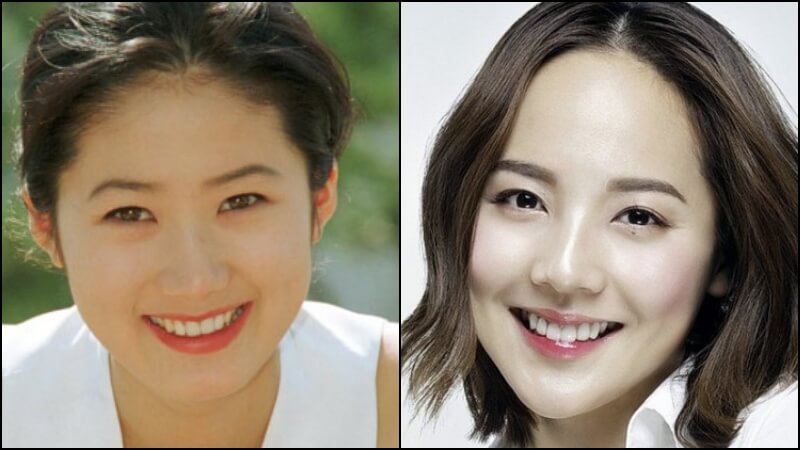 심은하와 유진의 산봉우리 이마 형태