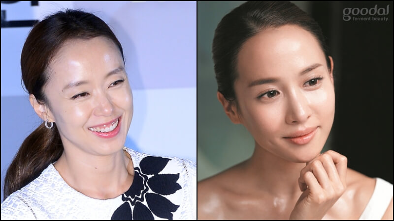 이마 뷰티의 모든 것 전도연 조여정 이마