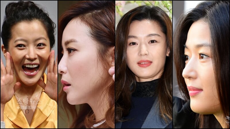 김희선과 전지현의 3자 헤어라인과 좁은 이마가 드러나는 옆모습 이미지
