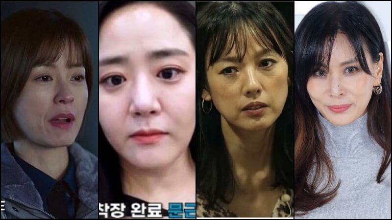 팔자주름이 두드러지는 정유미 문근영 이효리 고소영